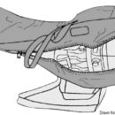 Fabbricato in pesante tessuto di poliestere, é rivestito all’interno con materiale imbottito antiurto resistente ad olio e carburante. Chiusura lampo perimetrale in nylon. Cinghie regolabili per trasporto a mano o a spalla. Ideale per stivare motori ausiliari, oppure per il trasporto o l'invernaggio.